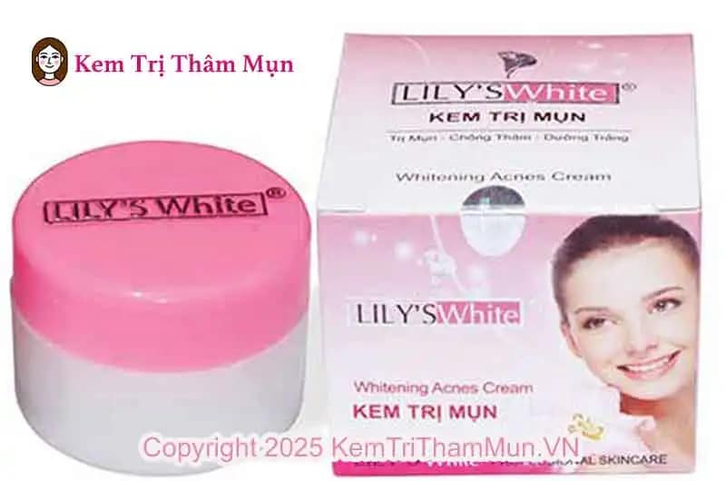 Kem trị mụn Lily’s White có tốt không? Review chi tiết